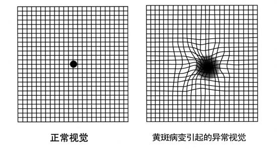 贵阳治疗眼底病医院